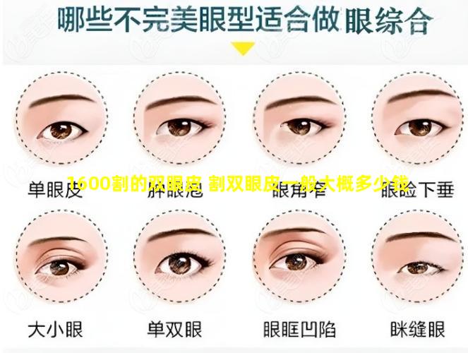 1600割的双眼皮 割双眼皮一般大概多少钱